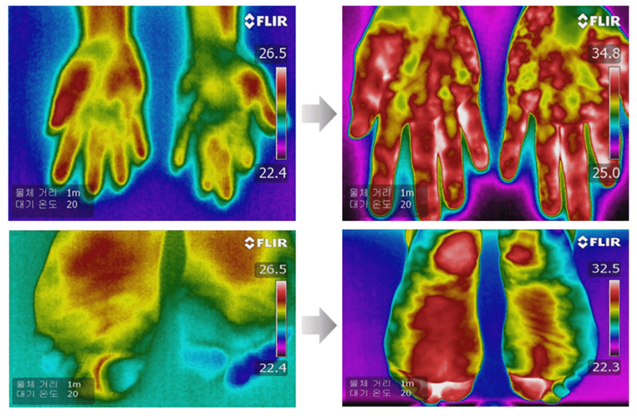 Der Einfluss der Vibrationsfrequenz auf die Finger- und Handdurchblutung - Therapiegold